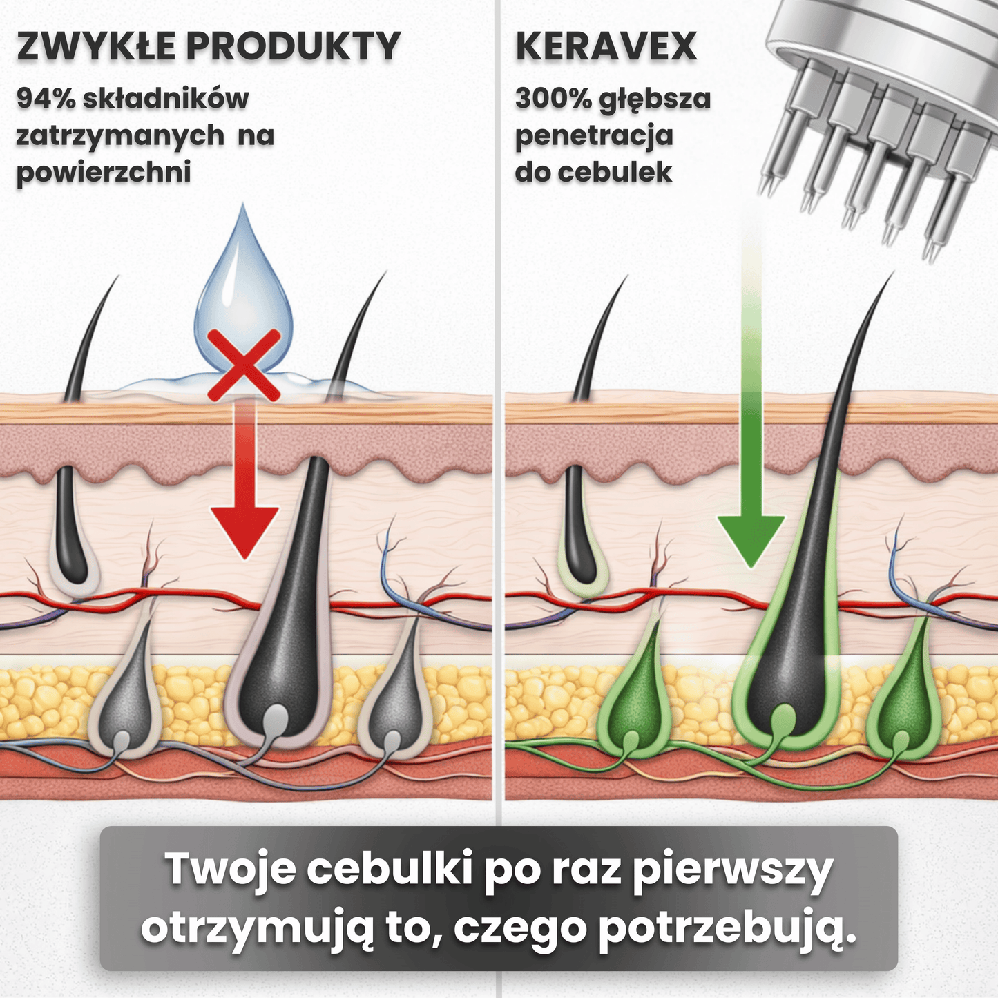 System Mikro Infuzji dla Wzrostu & Gęstości Włosów