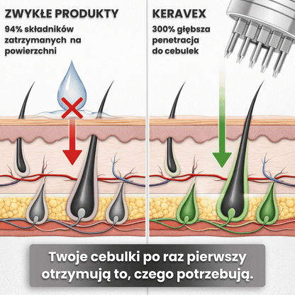 System Mikro Infuzji dla Wzrostu & Gęstości Włosów
