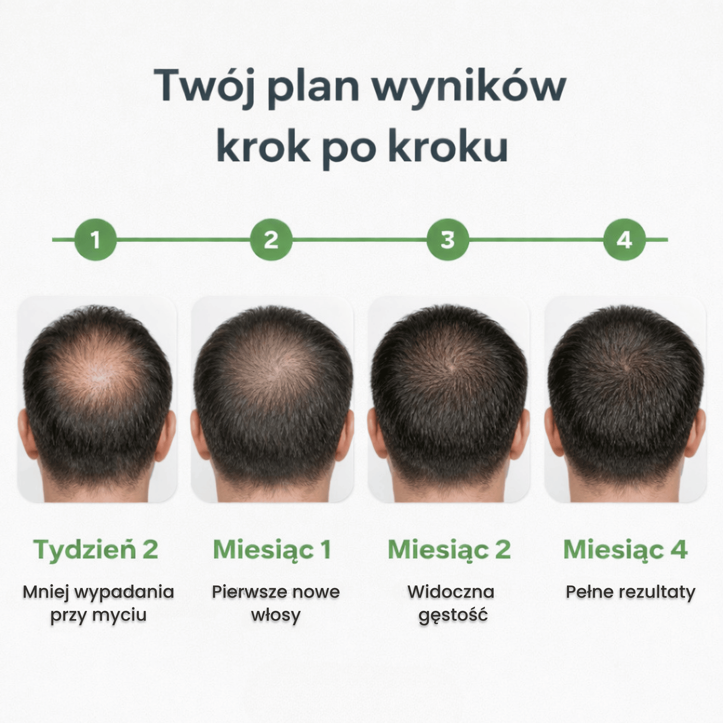 System Mikro Infuzji dla Wzrostu & Gęstości Włosów