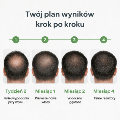 System Mikro Infuzji dla Wzrostu & Gęstości Włosów